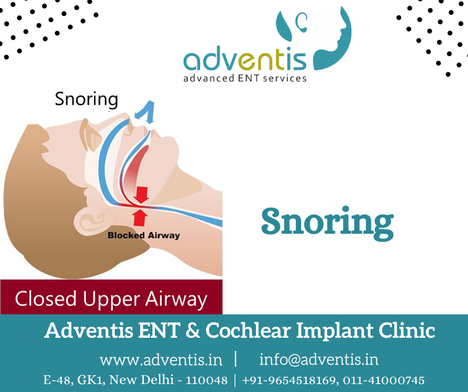 Implant for snoring