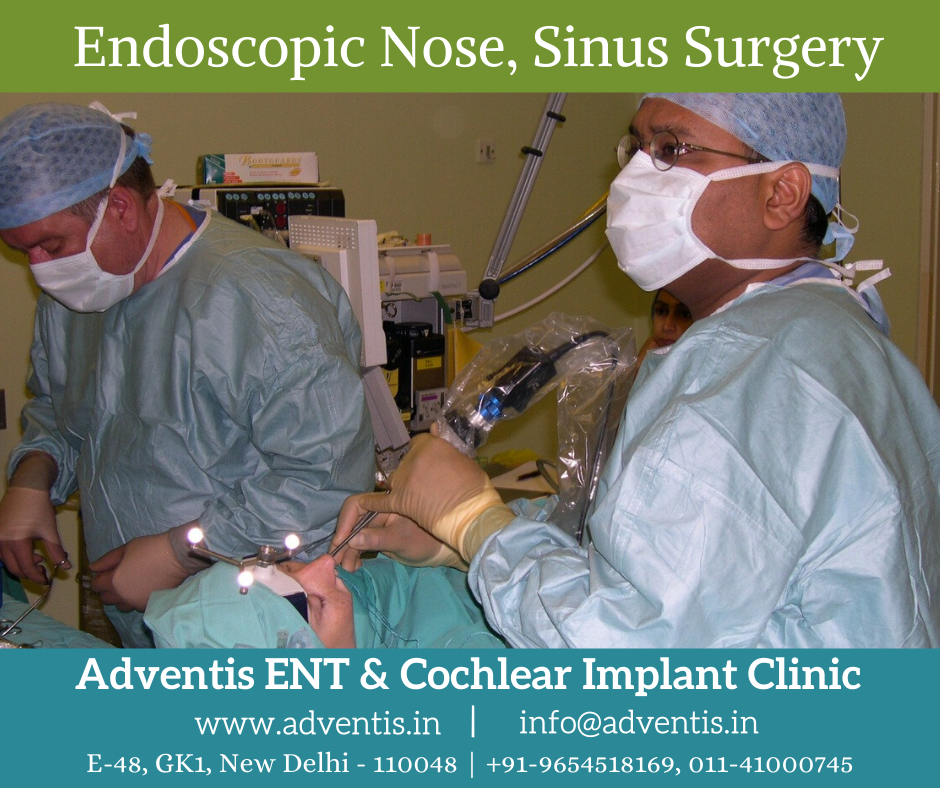 Best Endoscopic Nose Sinus And Skull Base Surgery In Delhi Adventis Ent 8243