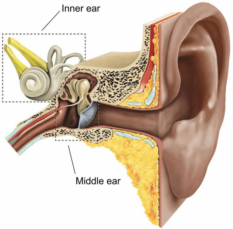 Stapedotomy Surgery in Delhi - Doctor, Treatment , Cost | Adventis ENT